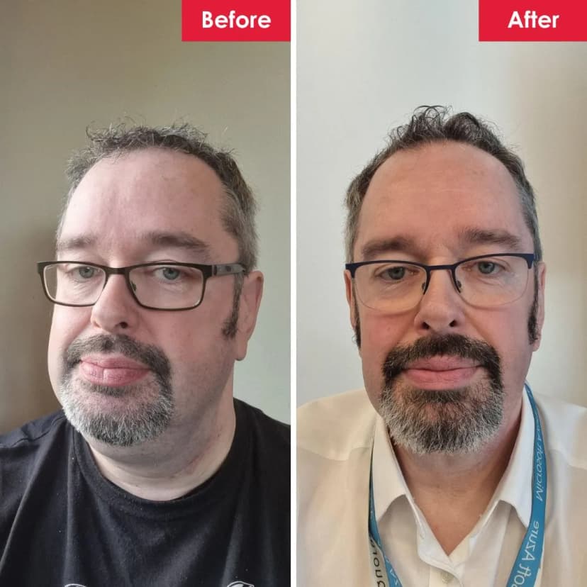 Alistair - transformation success story